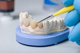Zahnersatz, Zahnersatzversicherung, Vergleich Zahnersatz