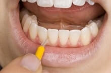 professionelle Zahnreinigung, Prophylaxe, Zahnzusatzversicherung